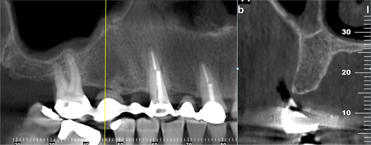 Implant ddi Imaging Centers - Maxilla Imaging